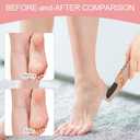 LQT Electric Foot File Rechargeable Callus Remover for Hard, Cracked Skin At-Home Pedicure Kit for Smooth Feet (Men & Women) (Pink)