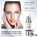 Super Vitamin C Serum for Face: All-in-One Hydrating Anti-Aging Formula by Vitamin C, Hyaluronic Acid, Caffeine-Firming, Lifting, Targets Dark Spots, Wrinkles, Vitamin C Face Serum (1.0 Fl Oz)