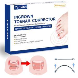 Nitinol Ingrown Toenail Corrector,at Home Ingrown Toenail Treatment,Curved Toenail Straightener,Ingrown Toe Nail ReliefIngrown Toenail Removal Kit (11/16 In,13/16 In)