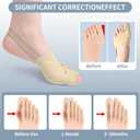 2 x DFQ 2 Pcs Bunion Corrector for Women & Men,Big Toe Straightener with Bunion Splint & Bunion Pads,Comfortable & Breathable Bunions Correction for Day/Night Support L (Beige)