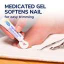 Dr. Scholl's INGROWN TOENAIL PAIN RELIEVER & TRIMMING KIT, 0.3 oz // Only OTC Treatment Proven to Relieve Ingrown Toenail Pain - Includes Medicated Gel + Foam Rings + Bandages + Clipper & Pusher Tools