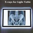 15 Pcs Human X-Ray Science Kit Tutorial Body Skeleton Xray Kit