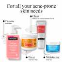 Neutrogena Oil-Free Acne Wash Pink Grapefruit Facial Cleanser - with Salicylic Acid for Clear Skin, Daily Face Wash for Oily & Acne-Prone Skin, Deep Cleansing Treatment, 9.1 fl. oz. Bottle