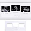 eletecpro Triple Ultrasound Picture Frame, Display 34 Sonogram Photo, Keepsake Frame for Pregnancy Announcements, Expecting Parents, Baby Shower, Gender Reveal Party, Baby Nursery Decor, White (15x8)