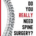 Do You Really Need Spine Surgery?: Take Control with a Surgeon's Advice