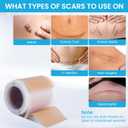 Silicone Scar Sheets Soft Silicone Scar Tape Roll, Reusable Scar Silicone Strips for Surgical Scars, Keloid, Acne Scars, Burn Scar, C-Section (1.6"x 120" Roll)