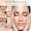 Photon Skin Rejuvenation Face & Neck Mask | LED Photon Red Blue Green Therapy 7 Color Light Treatment Anti Aging Spot Removal Wrinkles Whitening Facial Skin Care Mask, White