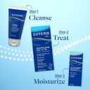 Differin Acne Treatment Gel, 30 Day Supply, Retinoid Treatment for Face with 0.1% Adapalene, Gentle Skin Care for Acne Prone Sensitive Skin, 15g Tube 