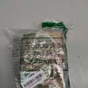 Outus Disease Teeth Model Dental Implant Teeth Model with Removable Tooth Dentist Standard Tooth Pathological Demonstration for Christmas Education Dental Supplies(Transparent,2 Pcs)