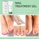 2 x 2Pcs Nail Fungus Treatment Gel, Natural Nail Repair Care Gel, Nail Oil for Growth & Strength, Nail Growth Serum for  Brittle Nails.