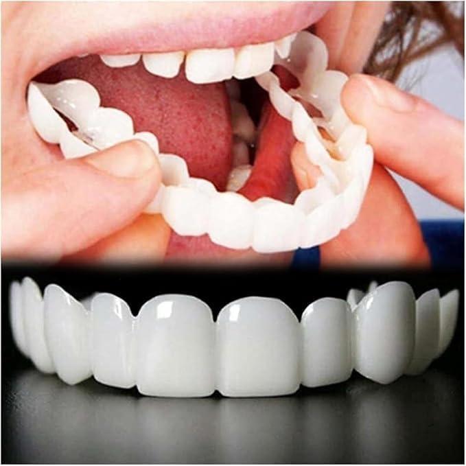 2 Pairs, Temporary Nature and Comfortable, Adjustable for Men and Women, Beautiful Smile(White) (2)