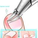 2 x Upgrade Ingrown Toenail Clipper Professional Podiatrist Curved Blade Nail Clippers Tool for Seniors Thick Ingrown Nails for Men Women