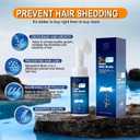 Minoxidil Hair Serum spray for Men and Women, 5% Minoxidil Hair Serumpromotes hair growth, makes hair and beard thicker and fuller (60ml)