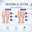 Varicose Veins Cream for Legs, Arnica, Witch Hazel & MSM, 1 Pack | Peppermint & Aloe Vera, Fast-Absorbing Non-Greasy Formula for Spider Veins and Daily Care of Heavy, Tired Legs