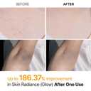 Dr.Melaxin Body Keratin Care Kojic Acid Turmeric Spray with AHA & PHA, Gentle Body Brightening & Exfoliating Peeling Solution for Dead Skin Cells & Texture, Korean Skincare, 6.76 fl.oz