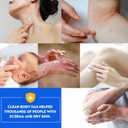 Soothe Your Skin with All Natural Eczema Cream Made from Sea Moss, Hydrating Comfort for Sensitive & Dry Skin  Fragrance Free Skin Care Solution - Upgrade 3