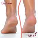 Finishing Touch Flawless Pedi Electronic Tool File and Callus Remover, Pedicure-New Version 