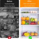 12 Pack Refrigerator Organizer Bins, 3 Sizes Stackable Clear Pantry Storage with Handles for Fridge, Freezer, Shelves, Drawer, Snack Organizer for Home & Kitchen