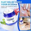 Soothe Your Skin with All Natural Eczema Cream Made from Sea Moss, Hydrating Comfort for Sensitive & Dry Skin  Fragrance Free Skin Care Solution - Upgrade 3