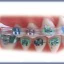 Morgan Bumper Braces Cover Lip Protector for Orthodontic Patients - Clear - Qty 2