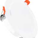 PATIKIL 6.5" Spring Ceiling Cover Plate, Recessed Light Trim Wall Mount Downlight Hole Cap Decorative Panel with Buckle Suitable for 4.9-6.1inch Round Hole Glass Ceiling Openings, White