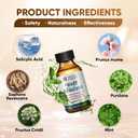 4pcs  "STAY STOKED" Wart Remover, 15ml Fast-Acting Wart Freeze Off with Natural Herbal Extracts - Gentle Yet Powerful for Common Warts, Plantar Warts on Hands/Feet-0123