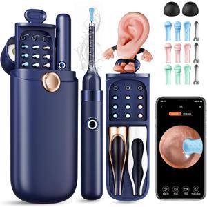 Ear Wax Removal, Ear Cleaner with Camera 1296P HD,Visual Ear Cleaner with 6 LED Lights and Flexible Tip,FSA HSA Eligible Items,Safe Ear Wax Removal Kit with Camera,Ear Cleaning Tool for Family Gifts (Black)