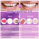 At-Home DIY Denture Kit: Full Set of Upper & Lower False Teeth for DIY Smile Transformation-ZZ5