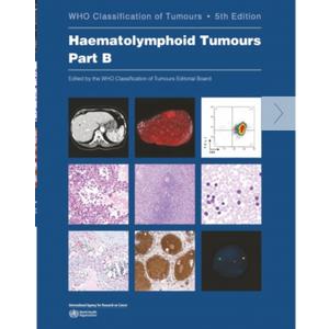 WHO Classification of Tumours: Haematolymphoid Tumours, 5th Edition (PART B)