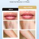 INNZA IPL Hair Removal with Ice Cooling Care Function for Women,Long-Lasting Results,999,999 Flashes Painless Hair Removal, Hair Removal Device for Armpits Legs Arms Bikini Line,Corded