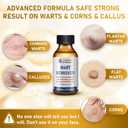 "STAY STOKED" Wart Remover, 15ml Fast-Acting Wart Freeze Off Liquid - The Strongest Wart Remover for Feet, Clinically Proven to Eliminate Stubborn Warts Resistant, Quick-Drying for Daily Use-H5520