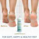 Callus Remover for Feet (Extra Strength) Foot Callus Remover Gel - Pedicure Tools for Feet Scrubber Foot Care Spa Essentials, 6oz