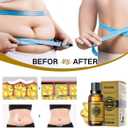 2 x 5PCS Belly Ginger Oil,Ginger Oil Massage,Ginger Essential Oil Care for Skin(10ml)