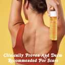 Bio-Oil Natural Skincare Oil Serum, Face and Body Moisturizer with Chamomile, Rosehip, and Lavender Oil, for Scars, Stretch Marks, Sensitive Skin, All Skin Types, 2 Oz (2 Fl Oz (Pack of 1))