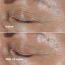 Clinique Smart Clinical Repair Wrinkle Correcting Eye Cream With Hyaluronic Acid + Peptides | Anti-Aging, Hydrating + Depuffing