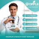 Wart Remover Liquid with Salicylic Acid for Wart Removal & Corn Care, Targeted Application, 1.01 Fl Oz