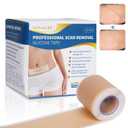 Silicone Scar Sheets, Silicone Scar Tape Roll (60x1.6), Professional Scars Removal Treatment, Scar Silicone Strips, Reusable Silicone Scar Strips Type for Keloid, C-Section, Surgery, Keloid, Acne