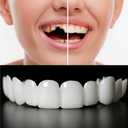 2 Pairs,Regain Beautiful Smile for Men and Women,Temporarily Adjustable(White)