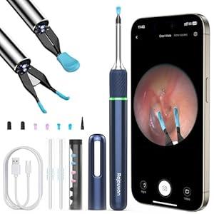 Rejauvan Ear Wax Removal Tool with Ear Camera, Ear Cleaner with Ear Pick &Tweezers Mode,1000W Ear Scope, Universal Gyroscope for Earwax Removal, Ear Wax Removal Kit 