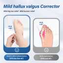 Bunion Corrector for Women & Men Big Toe, Suitable for Mild Hallux Valgus Pain Relief,Correct Toes for Day & Night Support, Fit for wearing with shoes, Bunion Relief Non-Slip,Toe Straightener (Large, Beige)