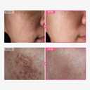 TOSOWOONG Arbutin 7% + Tranexamic Acid 4% Cream, 70,000ppm Arbutin, 40,000ppm TXA, Niacinamide, Glutathione, Dark Spots, Freckle, Blemishes, Pigmentation, Korean Skin Care, 50ml, 1.69 fl.oz.