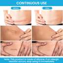 3 x Silicone Scar Sheets Soft Silicone Scar Tape Roll, Reusable Scar Silicone Strips for Surgical Scars, Keloid, Acne Scars, Burn Scar, C-Section (1.6"x 60" Roll)