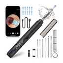 Ear Wax Removal Tool Camera, Ear Cleaner with Camera, Ear Cleaning Kit 