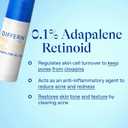 Differin Acne Treatment Gel, 90 Day Supply, Retinoid Treatment for Face with 0.1% Adapalene, Gentle Skin Care for Acne Prone Sensitive Skin, 45g Pump