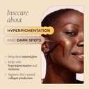 Glo Melanin Dark Spot Remover for Face - Dark Spot Corrector Serum with Vitamin C - Reduces Discoloration and Hyperpigmentation