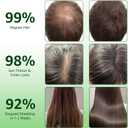 Hair Regrowth System, Ginseng, Eclipta Prostrata, Peppermint & Ginger Root | Supports Thicker-Looking, Stronger Hair for Men & Women