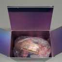 QearFun Kids Headphones Wired with Mic, 85/94dB Safe Volume Limit, Foldable Over Ear, Tangle-Free Cord & Sharing Port, Wired On-Ear Headset for School, Chromebook, Tablet, Travel - Boys & Girls (Pink aurora)