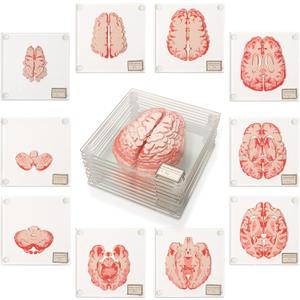 ThinkGeek Anatomic Brain Specimen Coasters Set of 10 for Neuroscience Medical Student Gifts Human Anatomy Generix Geek