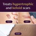 Mederma Medical Grade Silicone Scar Sheets - Improves Appearance of Old & New Scars from Injury, Burn & Surgery, Breathable & Flexible, 4 Count