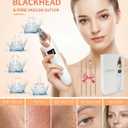 2026 Pore Vacuum, USB Rechargeable Blackhead Remover Vacuum,3 Levels Adjustable Pore Vacuum Blackhead Remover, with 5 Suction Power,6 Probes,Face Vacuum Pore Cleanser for Women & Men-White